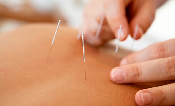 akupunktúra a potencia növelésére
